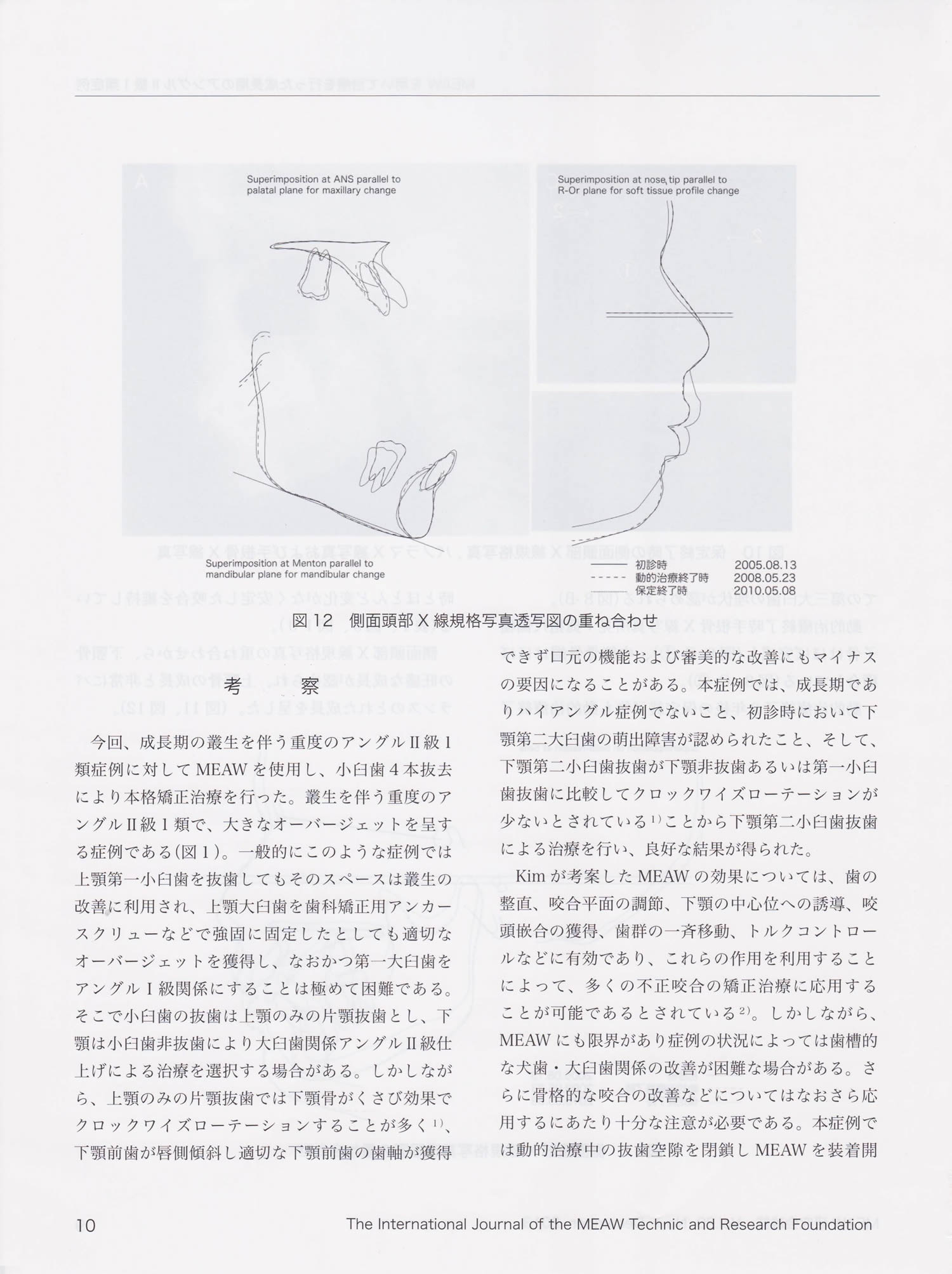 09.jpg